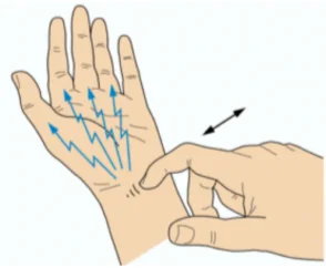 carpal tunnel syndrome chiropractor glastonbury