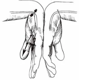 best carpal tunnel syndrome chiropractor