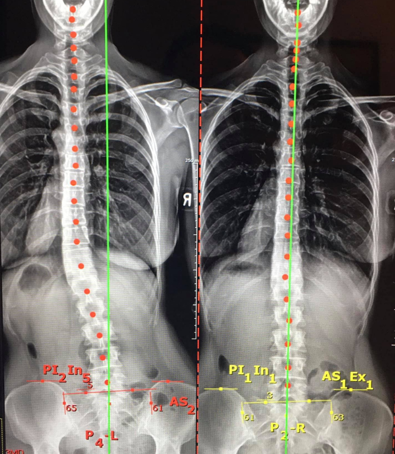 Disc Injury Relief Glastonbury CT